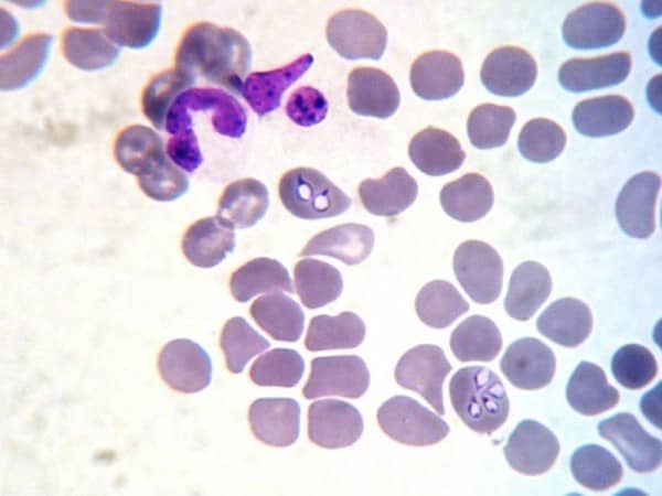 babesia
